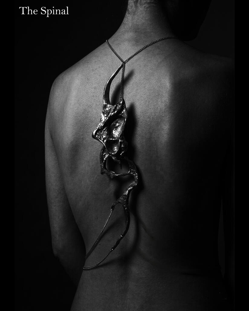 The Spinal The Spinal